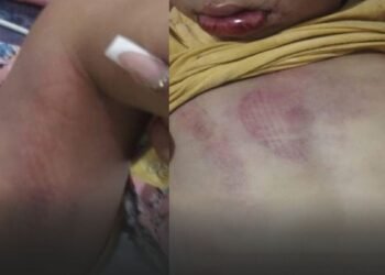 PAI É PRESO APÓS FILHOS DE 4 E 1 ANO SEREM ENCONTRADOS COM SINAIS DE AGRESSÃO EM NOVA GRANADA