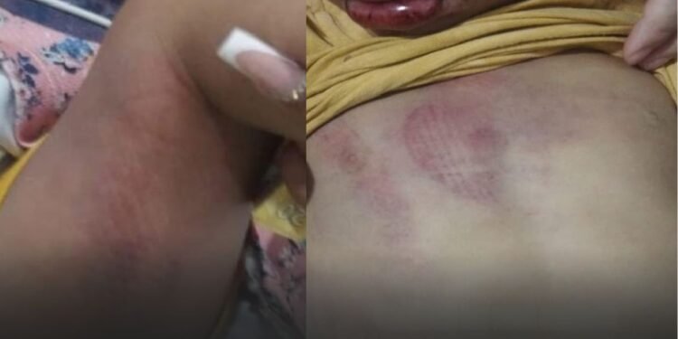 PAI É PRESO APÓS FILHOS DE 4 E 1 ANO SEREM ENCONTRADOS COM SINAIS DE AGRESSÃO EM NOVA GRANADA
